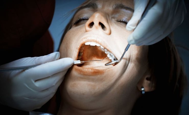 Teeth Inspection