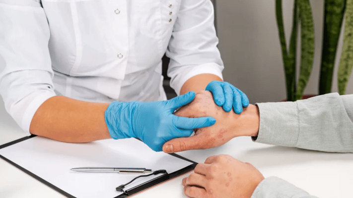 A man was left with large burns across his body after a dermatology clinic gave him a treatment for a different patient, the health watchdog has found.
