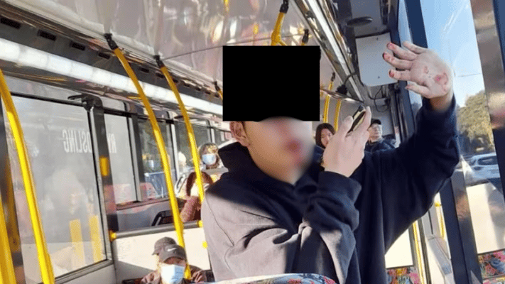 The victim lost three teeth and sustained damage to two others in the attack