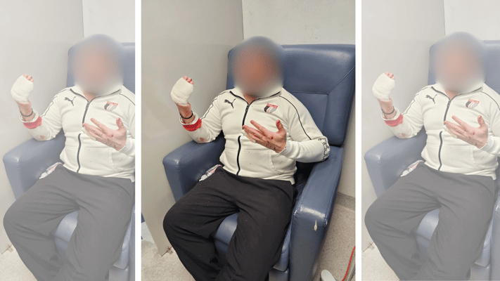 A young Indian chef’s middle and ring fingers of his right hand were severed by a man in a shocking highway attack near Otahuhu on Friday at 1:30 pm.