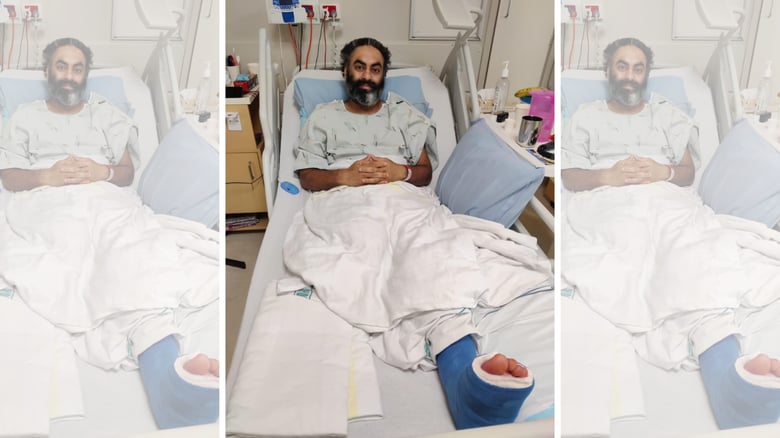 Pawanjit Singh Ghatora Loses Leg After Being Hit By A Car