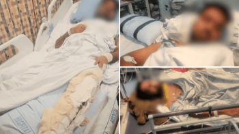 Man Arrested For Brutally Beating Indian Worker In Auckland