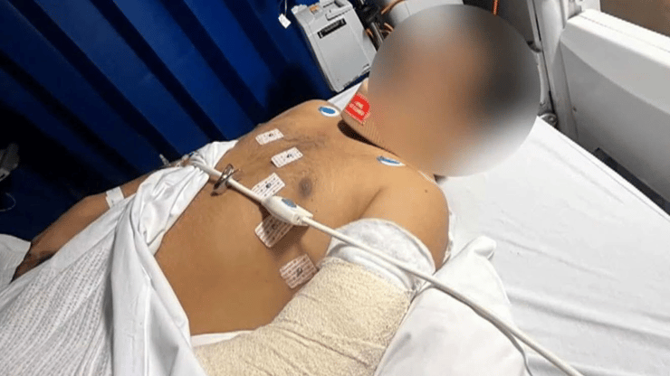 Saurabh Anand was ambushed by five boys outside Central Square Shopping Centre in Altona Meadows