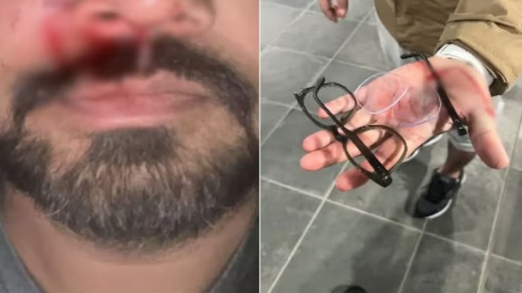 Indian-Origin Man Assaulted In Dublin