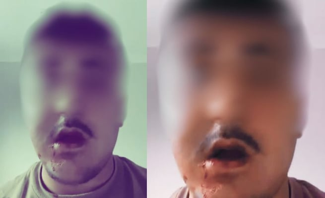 The 18-year-old after the violent assault. (Supplied photo)