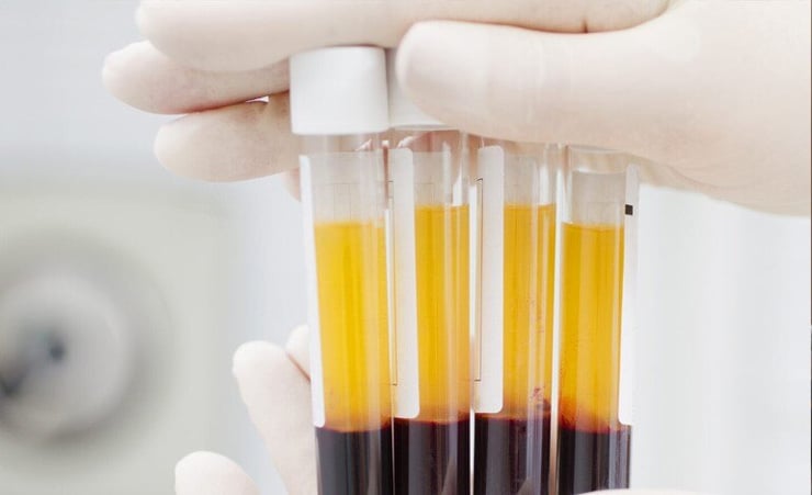 Delhi to try out plasma technique on critical Covid patients