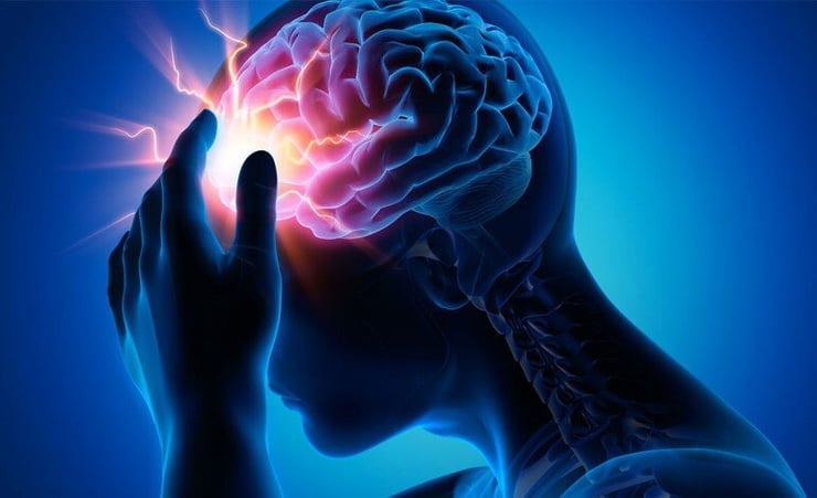 Everything you need to know about a brain stroke