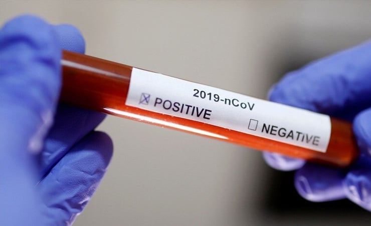 UK sent 50,000 COVID-19 samples to US for testing