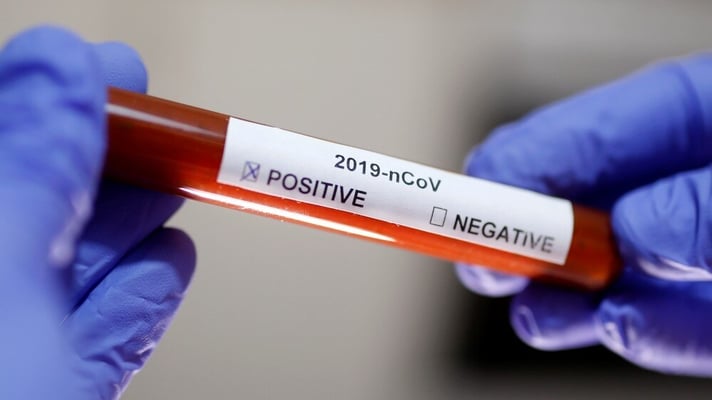 This tool can detect antivirus antibody in 20 minutes