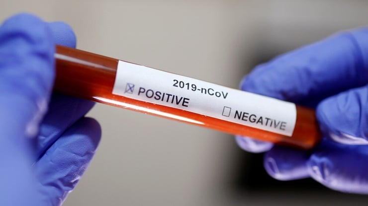 Global COVID-19 cases top 16.4 million: Johns Hopkins