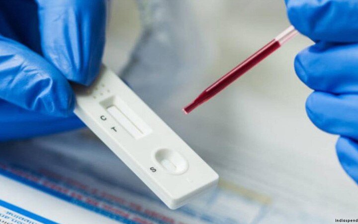 Delhi Govt reduces RT-PCR test cost to Rs 800