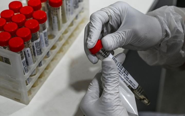 New Covid-19 variant does not cause illness more severe than others - study