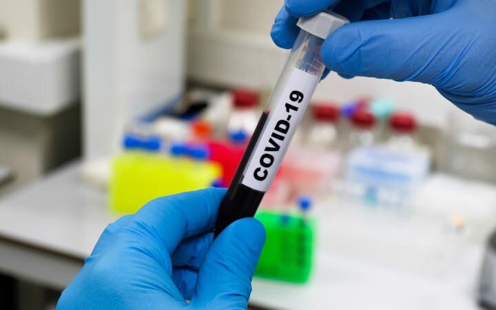 Covid-19: Why Australia's quarantine rules are changing