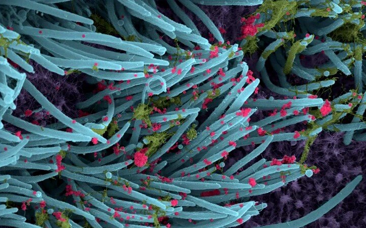 Novel coronavirus invades mouth's cells, shows new evidence