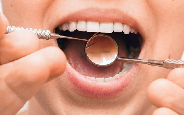 Oral hygiene to prevent heart infection from mouth bacteria