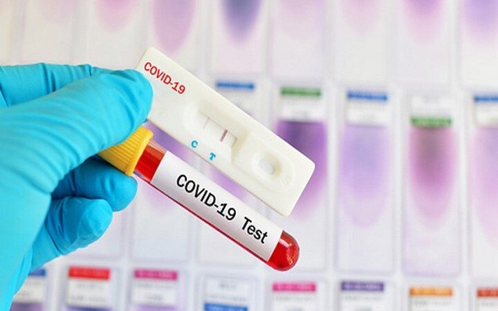 New COVID-19 rapid test kit receives scientific seal of approval