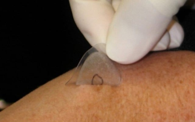 Milan woman's skin sample may hold clues to Covid-19 origins
