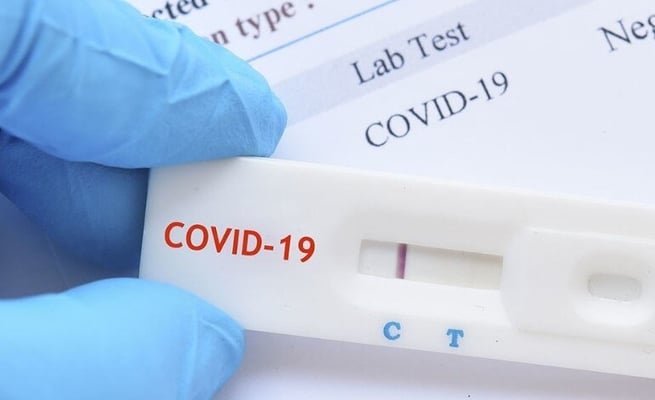Government green lights rapid antigen testing