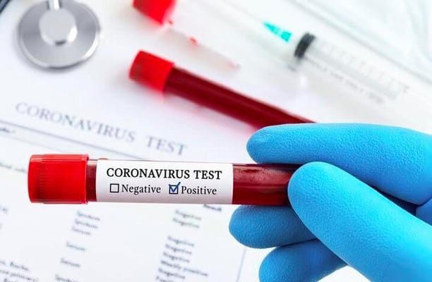 Fears Covid-19 cases will surpass 1000 a day by Christmas if restrictions eased