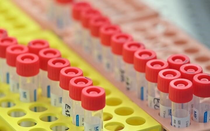 Covid-19 update: 55 new community cases in NZ; five more Omicron cases in MIQ
