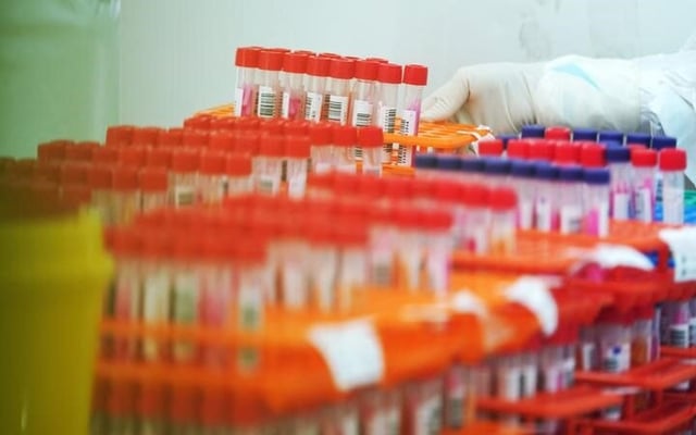 Covid-19: Omicron case was active in the community, Ministry of Health confirms