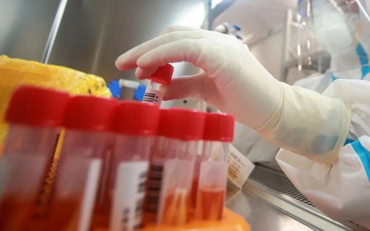 Covid-19 update: 105 new community cases, 15 new Omicron cases identified