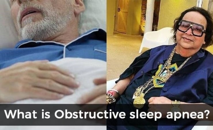 Obstructive sleep apnea: The condition that proved fatal for late Bappi Lahiri