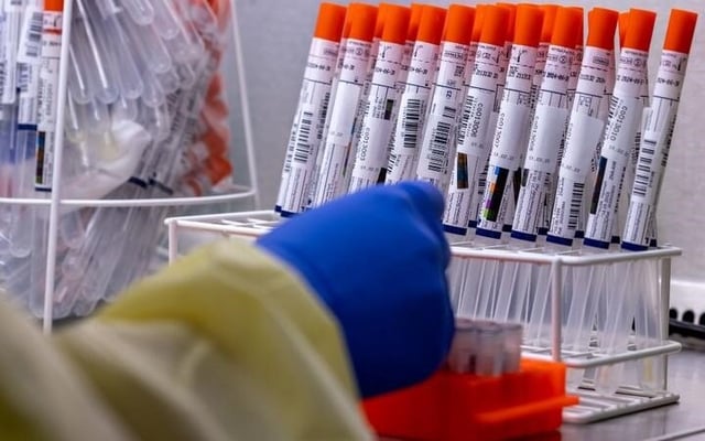 Covid-19 update: 22,152 new community cases, 405 people in hospital
