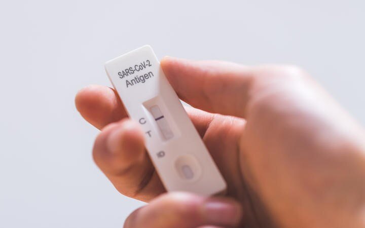 Ministry of Health urges caution over dropping Covid-19 case numbers