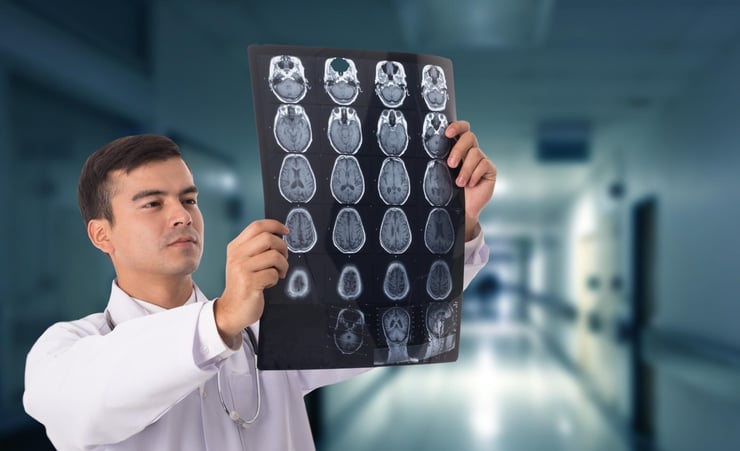 Scans reveal how Covid-19 may change the brain
