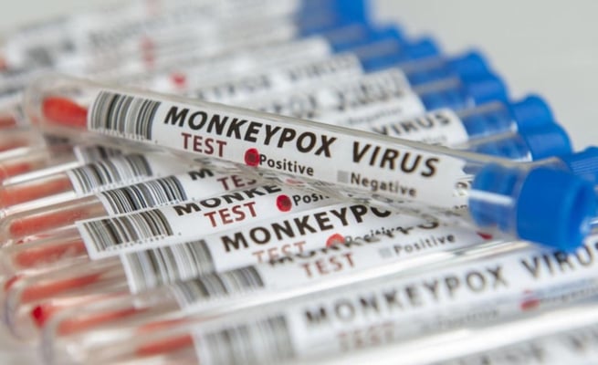 Monkeypox: 'A short window of opportunity to act' - Experts push for stronger response