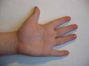 Anti-smacking referendum launched