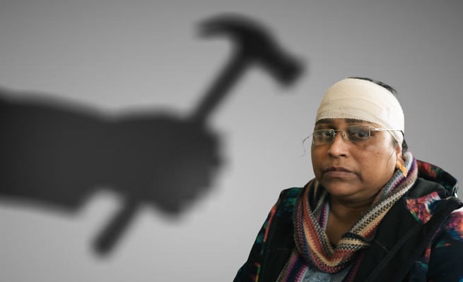 Hammer attack: Fundraiser after dairy owner suffers seven stitches in head