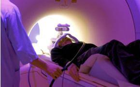 Indians at high stroke risk