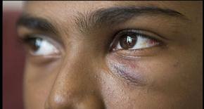 Teenager beaten in racist attack