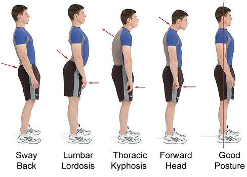 Bad posture for long hours contributing to osteoarthritis among youth