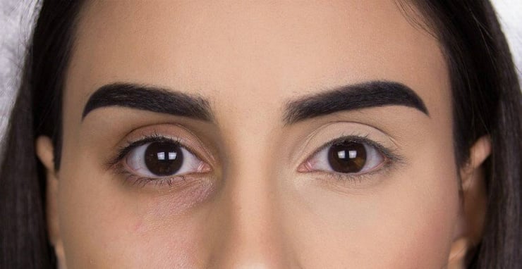 Cure dark circles in quick, effective way
