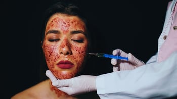'Vampire Facial' Offered By A Salon Without Medical Qualifications?
